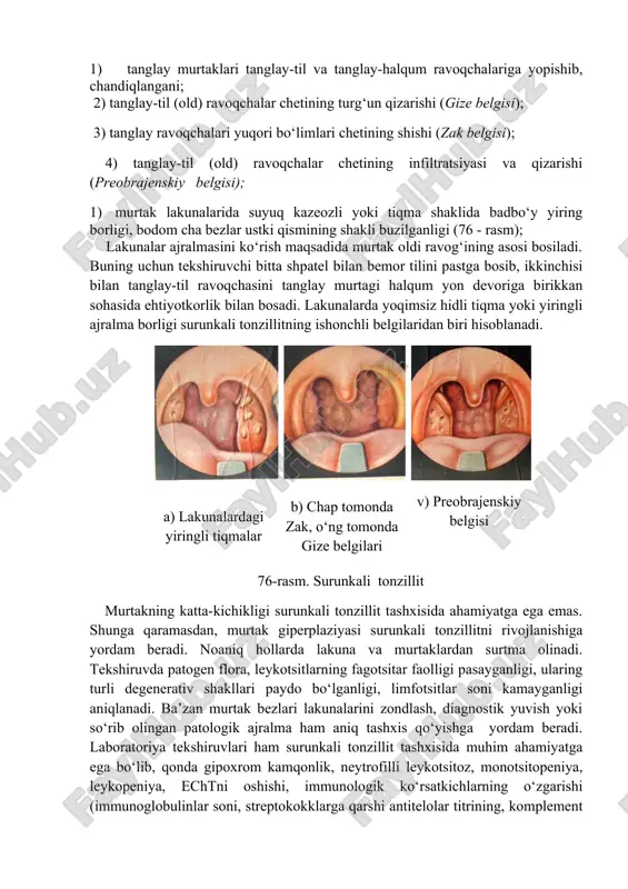 qator a’zolar faoliyatining buzilishiga yoki organizm himoya kuchini pasayishiga, xususan uni autosensibilizatsiyasiga olib keladi. murtak asab tolalarining buzilishi limfadenoid to‘qima trofikasiga ta’sir ko‘rsatib, natijada funksional va morfologik o‘zgarishlar yanada chuqurlashib, jarayon toksik-allergik bosqichiga o‘tadi. murtak asab elementlaridagi ayrim o‘zgarishlar (asab tolasi varikozi, retseptorlar uchi sharsimonligi) organizmning kompensator - moslashuv reaksiyasi bo‘lib, destruktiv o‘zgarishlarni bartaraf etilishiga yordam beradi. tashxis anamnez malumotlari, bemor shikoyatlari, limfa tugunlari kattalashishi, og‘rishi, faringoskapiya, labaratoriya, allergologik, immunologik, bakteriologik va boshqa tekshiruvlar asosida qo‘yiladi. surunkali tonzillit tashxisini kasallik xuruji paytida (anginada) qo‘yish tavsiya etilmaydi, chunki bemor shikoyatlari va faringoskopiya manzarasi jarayonning surunkali kechimini emas, balki uning o‘tkir bosqichini aks ettiradi. anamnez ma’lumotlarida tez-tez takrorlanib turgan anginalar haqida ma’lumotni mavjudligi surunkali tonzillit tashxisinini ishonchli belgisi hisoblanadi. odatda surunkali tonzillit bir yilda 2-3 marta, ba’zan 5-6 marta avj olib turadi, ammo bir yilda 1 marta kuzatilgan anginani ham b.s.preobrajenskiy fikricha tez-tez takrorlanuvchi angina sifatida baholash lozim. 4% hollarda surunkali tonzillitning …