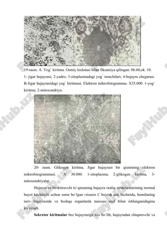 murtqa-li hayvon hujayralarida 0,1 dan 6 mkm gacha bo`ladi (21-rasm). sitoplazmasida melanin granulalari ko`p bo`lgan hujayralar pigment hujayralari - melanotsitlar yoki melanoforlar nomini olgan. ular asosan himoya funktsiyasini o`taydi. ma’lumki, melanin tirozinning tirozinaza bilan oksidlanish mahsulotidir. ximiyaviy tarkibi jihatidan melanin adrenalinga va serotoninga yaqin turadi. melanotsitlarni elektron mikroskop ostida o`rganish melanin donachalarini 2 qismdan: protein tanachadan va ko`pgina mayda osmiofil granulalardan tuzilganligini ko`rsatdi. 21-rasm. pigment kiritma. epidermisdagi pigment hujayra (melanotsit). elektron mikrofotogramma. x l000. 1_yadro; 2-melanin donachalari; 3-tonofilamentlar. ba’zi bir pigmentlar faqatgina hujayra nobud bo`lgandan so`ng sitoplazmadan chiqadi va makrofaglar tomonidan fagotsitoz qilinadi. bunday pigmentlarga to`qimalarda ko`p uchraydigan sariq va kulrang pigment - lipofustsin kiradi. uning granulalari ko`proq nerv hujayralarida, miokard tolalarida (qarishning distrofik jarayonlarida) uchraydi. shuning uchun bu pigmentni qarish pigmenti deb ataladi. bu pigment yana jigar, buyrak usti bezlari (po`stloq qismining to`rsimon zonasida), neyrogipofiz - pituitsit hujayralarida va boshqa a’zolarda uchraydi. buqa mushagidan ajratib olingan lipofustsin o`rtacha elektron …