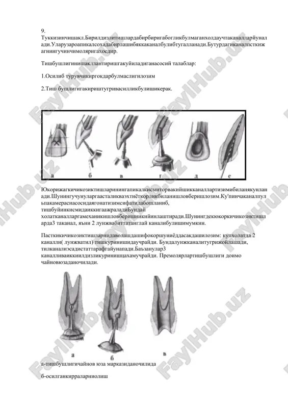 2 distal - lunj, 2 tanglaĭ ildizivakanaligaegabulishimumkin.ba'zanbittaildizvakanalga, 3 taildizvakanalga, ikkiildizvakanalga, 3 tauzarokushilibketganildizlartizimigava 4 takanalgaegabulishimumkin. pastkikatgaoziktishlarida 30% xolatda4 takanaltizimiuchraĭdi: 2 takanaldistalildizdava 2 medial.butishlar 3 taildizgaegabulishimumkin. uchinchiildizdistal - tipbulibxisoblanadi tishbushliginshaklllantirishdapulpakamerasiningtomixajmigamuvofikravishdakirishĭunalishinishakllantirishlozim.bushlikdevorlarikanalgaasbobnikirishiuchuntuskinlikkilmasligilozimdir.shuningdekbarchakanallartopilishivaishlovberilishishart.aksxoldaperiodontdayaliglanishjaraëniningyuzagakelishextimoliortadi.