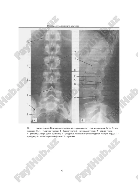 ularok;, engil kifoz va lordoz normal x,o- lat. birok; kuchli kifoz va lordoz patologiya x,isoblanadi. umurttsa po- gonasining yon tomonlarga (ya'ni frontal kesimda) tsiyshayishi skolioz deb aytiladi. 9g-rasm. bel lordozi. 9 g-raem. buyin lordozi. 91b-rasm. kukrak kifozi. instrumental tekshiruv usullari ~ 4 ~ 92- rasm. norma. bel umurtk;alari rentgenogrammasi tugri proektsiyada (a] va yon pro- ektsiyada (b). 1 - umurttsa tanasi; 2 - bugim usigi; 3 - kundalang usik;; 4 - utkir usik;; 5 - umurttsalararo disk bushligi; 6 - umurtk;a tanasini tutashtiruvchi yuk;ori parda; 7 - k;ovurga; 8 - yonbosh-dumgaza bugimi; 9 - dumgaza. instrumental tekshiruv usullari 93- rasm. kalla suyagi rentgeni. norma, (a - tugri proektsiya, b - lateral proektsiya). 1 - peshona suyagi; 2 - tepa suyagi; 3 - ensa suyagi; 4 - chakka suyagi; 5 - ponasimon suyak; 6 - galvirsimon suyak; 7 - kuz kosasi; 8 - kshori jag va uning sinusi; 9 - burun …