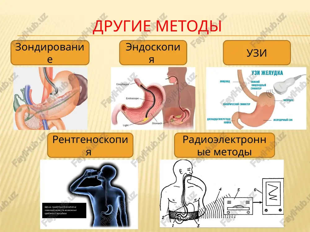 fermenti; obrazovanie geparina, prepyatstvuyushego svertivaemosti krovi; sintez belkov plazmi krovi (fibrinogen, protrombin); razrushenie eritrotsitov . regulyatsiya pishevareniya nervnaya gumoralnaya osushestvlyaetsya s pomoshyu veshestv tak, gastrin i atsetilxolin usilivayut sokrasheniya i rabotu, a adrenalin i noradrenalin — tormozyat. osushestvlyaetsya impulsami. simpaticheskaya ns tormozit, a parasimpaticheskaya – usilivaet. deystvuyut refleksi: uslovnie bezuslovnie pisha popala v organ pishevaritelnoy sistemi pri vide, zapaxe ili mislyax o ede pishevarenie v rotovoy polosti proisxodit: 1. izmelchenie pishi – s pomoshyu zubov 2. smachivanie pishi – mutsini i voda slyuni 3. pervichnaya ximicheskaya obrabotka: fermenti amilaza, maltaza rassheplyayut uglevodi 4. chastichnoe obezzarajivanie – deystvuet lizotsim 5. formirovanie pishevogo komka – yazik, zubi, slyuna. primerno cherez 20 s proisxodit glotanie – bezuslovniy refleks pishevarenie v jeludke - dlitsya ot 3 do 10 ch. - jeludochniy sok videlyaetsya tolko jelezami jeludka. on sostoit iz: 1) vodi, 2) solyanoy kisloti. ona opredelyaet kisluyu reaktsiyu sredi, aktiviruet fermenti, obladaet antibakterialnim deystviem …