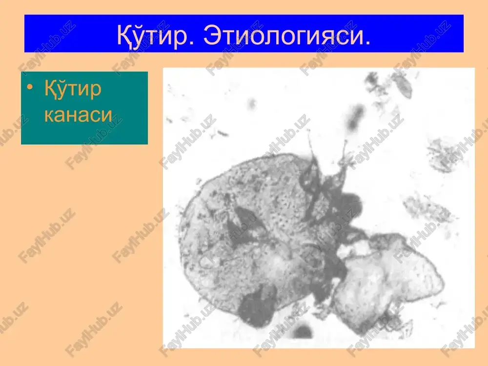 a ishlatiladi: ivermektin- 1kg vaznga 200mkg dozada 1marotaba per os qabul qilinadi. bitliqilik bitlar qon so'ruvchi ektoparazitlardir. bir kunda bitta bit 0,3-0,5mlgacha qon so'radi. odamda bosh biti, kiyim biti va qov biti tafovut qilinadi. bosh biti to'g'ridan-to'g'ri odamdan uning bosh kiyimi va ko'rpa-to'shaklari orqali yuqadi va boshning sochli qismida xayot kechiradi. 1-1,5 oyda urg'ochi bit 100-150 tagacha tuxum (sirka) qo'yadi, ular sochga maxkam yopishgan bo'ladi. sirkalarning rangi oqimtir-sarg'ish bo'lib, yaxshi ko'rinib turadi. bit qon so'rganda so'lak chiqaradi, odamlarning bu so'lakka sergirligi (allergik reaktsiyasi) xar xil bo'ladi, shu tufayli qichishish darajasi xam xar xil bo'ladi. bitliqilikda sochlar bir-birlariga yopishib ketgan, bosh terisi qaloqlar bilan qoplangan, ikkilamchi infektsiya tufayli follikulitlar, impetigo kabi kasalliklar yuzaga kelgan, bo'yin, quloq orti soxalaridagi limfa tugunlari kattalashgan bo'ladi. kiyim biti ichki kiyimlarning choklarida, burmalarida joylashadi, o'lchami kattaroq. bit chaqqanda qattiq qichishish paydo bo'lishi oqibatida ekskoriatsiyalar, gemorragik qaloqlar, ikkilamchi pigmentatsiyalar, yiringli kasalliklar (impetigo, follikulit, furunkul va x.k.) uchraydi. …