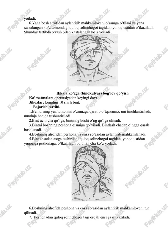 o’ngga qarab boshlanadi. 4.boshning atrofidan peshona va ensa so’asidan aylantirib mahkamlanadi. 5.bint ensadan astga tushiriladi quloq solinchogoi tagidan, yonoq ustidan yuqoriga peshonaga, o’tkaziladi, bu bilan cha ko’z yoiladi. 6.boshning atrofida peshona va ensa so’asidan aylantirib mahkamlovchi tur qilinadi. 7. peshonadan quloq solinchogoi tagi orqali ensaga o’tkaziladi. 8. yana mahkamlovchi tur qilinadi ensaga krestsimon bog’lov qo’yish ko’rsatmalar: bo’yin so’asida o’tkazilgan ocratsiyadan keyingi davrda, ensa sohasidagi shikastlar. jihozlar: kengligi 10 sm li bint. bajarish tartibi. 1. bemorning yuz tomonini o’zimizga qaratib o’tqazamiz, uni tinchlantiriladi, muolaja haqida tushuntiriladi. 2. bint uchi cha qo’lga, bintning boshi o’llg qo’lga olinadi. 3. bint boshning peshona qismiga qo’yiladi boshning atrofida peshona va ensa sohasini aylantirib 2 ta mahkamlovchi tur qilinadi. 4. bint ensaga, keyin bo’yinga quloq lagidan o’tkaziladi, bo’yinni aylantirib o’tib yana ensa va bosh atrofida aylantiriladi. 5. bir necha marta sakkizsimon aylanishlar qilinadi, har o’ram oldingisining 2/3 enligining ustini yopadi. 6. bog’lov mahkamlovchi tur bilan (bosh …