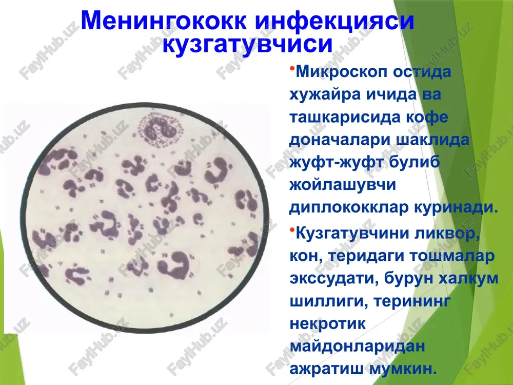 okokkli sepsis) toshma ulchamlari nuktali kon kuyilishlidan to markazda joshlashgan yirik nekrozalrgacha bulishi mumkin. keyinchalik yirik zararlanish soxalarida nekrozlar kuchadi va chandiklar xosil buladi. toshmaning kayta rivojlanishi zaralanishning kengligi va xarakteriga boglik. rozeolez-papulez toshmalar 1-3 kundan sung izsiz yukoladi, chukur nekroz soxalarida uzok vakt bitmaydigan yaralar xosil buladi. 3-7 % xollarda bugimlar zaralanishi – artritlar kuzatiladi. uveitlar, xamda boshka a'zo va tizimlarning zaralanishi xam kuzatilishi mumkin. meningokoktsemiyaning klinik kurinishlari meningokoktsemiya meningokokktsemiyadagi toshmalar meningokokemiyaning ogirlik mezoni ogirlik buyicha: engil, urta ogir ogir shakli. ogirlik mezoni : toksikoz simptomning namoenligi xushning uzgarishi tana xaroratining darajasi gemorragik- nekrotik toshmaning kupligi va razmerlari meningokokkemiyaning yashinsimon kechadigan shakli - (uta utkir meningokokkli sepsis) kasallik utkir, tusatdan xarorat kutarilishi 39-40•s bilan boshlanadi, kaltirash, et uvishishi, kupgina gemorragik toshishi bilan namoenlanadi, katta kismiga kon kuyilish kuzatiladi, ab tushadi, kon aylanish etishmovchiligi, dvs, mushaklar gipotoniyasi, talvasalanish rivojlanadi. bu shakl infektsion-toksik shok deb baxolanadi. adekvat va uz vaktida davo …