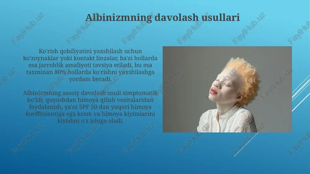 albinizm kasalligi - Page 4
