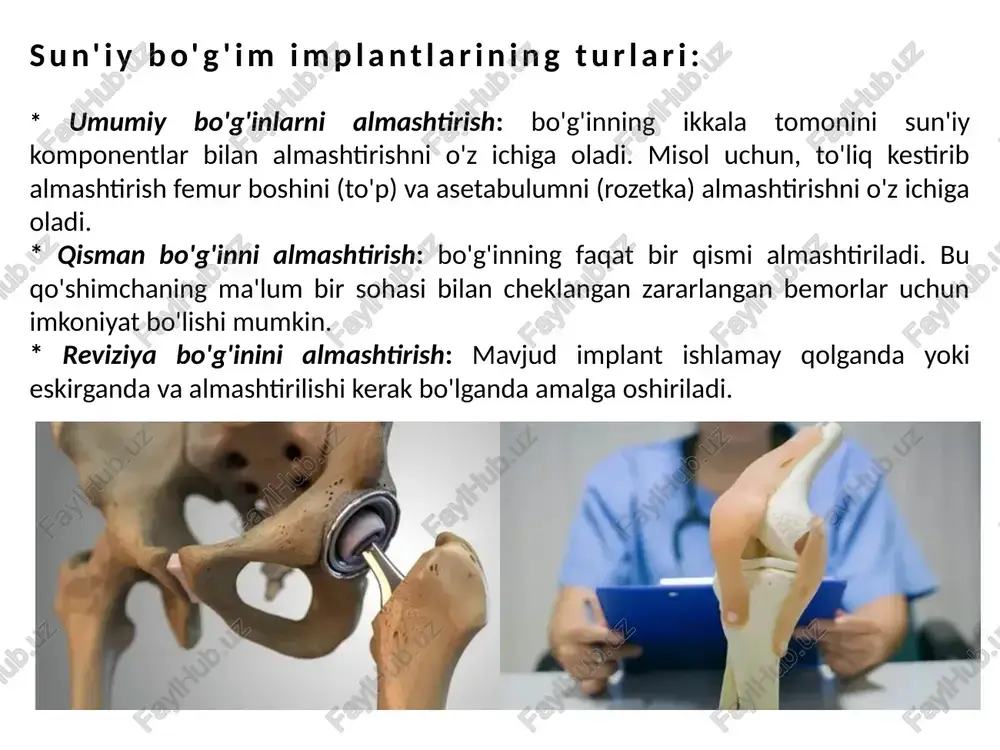: * drop minorasi sinovi: yiqilish paytida boshdan kechirganlar kabi to'satdan ta'sirlarga bardosh berish qobiliyatini baholash uchun implantga og'irlik tushiradi. * instrumental zarba sinovi: zarba paytida implant tomonidan so'rilgan kuch va energiyani o'lchaydi va uning zarba qarshiligi haqida ma'lumot beradi. materialning xarakteristikasi: * tortishish sinovi: implant materiallarining mustahkamligi va egiluvchanligini o'lchaydi. * qattiqlik sinovi: materiallarning sirt qattiqligini baholaydi, bu aşınma qarshilik uchun muhimdir. * mikrostruktura tahlili: implantatsiya materiallarining sifatini baholash va yuzaga kelishi mumkin bo'lgan nuqsonlarni aniqlash uchun ularning mikro tuzilishini tekshiradi. sinov standartlari va qoidalari: * astm international (astm): tibbiy asboblar, jumladan, sun'iy bo'g'inlar uchun ixtiyoriy konsensus standartlarini ishlab chiqadi. * xalqaro standartlashtirish tashkiloti (iso): tibbiy asboblar, jumladan, bo'g'inlarni almashtirish uchun xalqaro standartlarni belgilaydi. * oziq-ovqat va farmatsevtika idorasi (fda): qo'shma shtatlardagi tibbiy asboblarni tartibga soladi va ishlab chiqaruvchilardan mahsulotlarni sotishdan oldin ularning xavfsizligi va samaradorligini ko'rsatishni talab qiladi. kuchga ta'sir qiluvchi omillar: * implant dizayni: implant dizaynida ishlatiladigan …