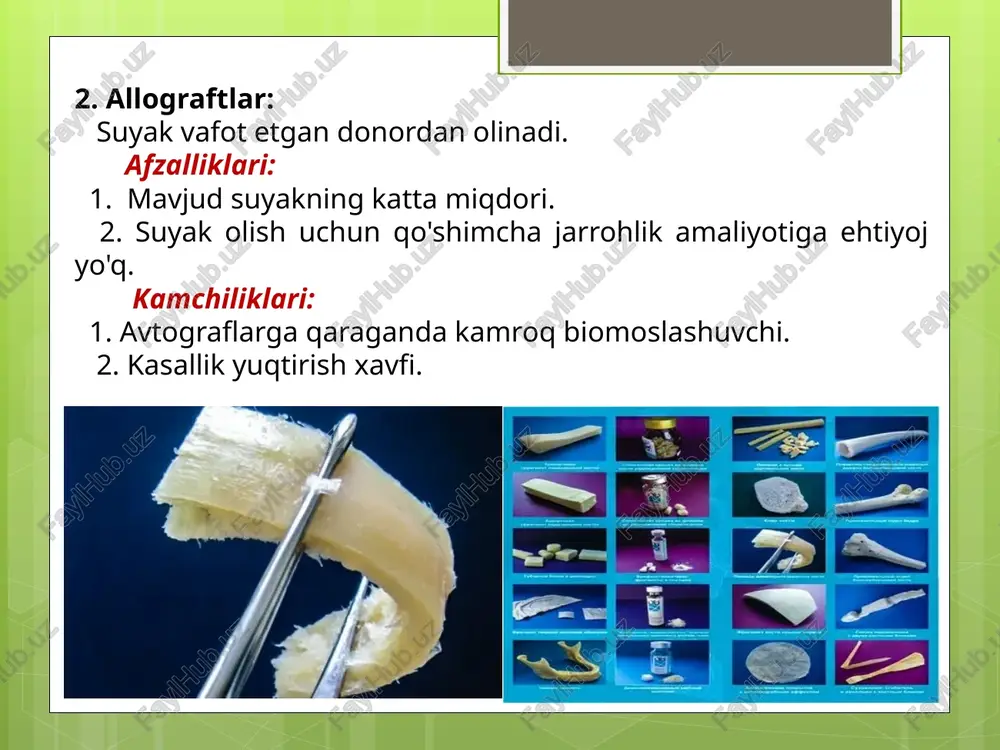 suyak transplantatlari - Page 4
