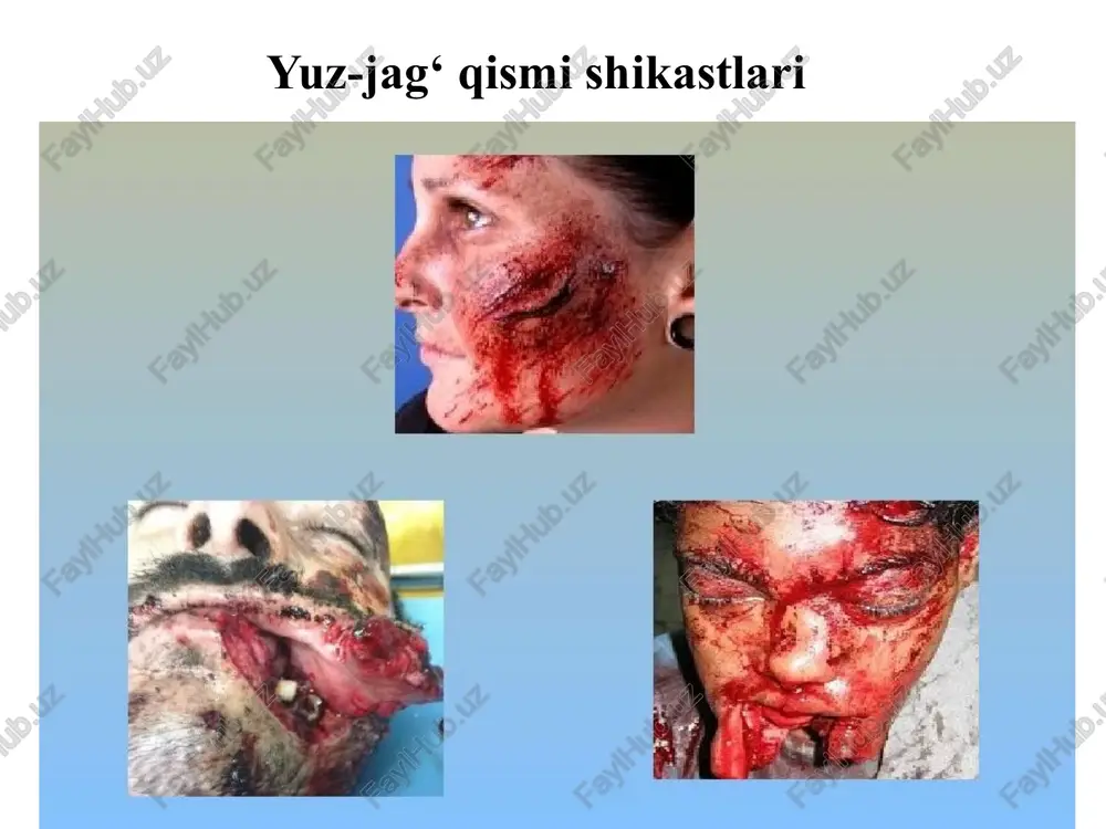 ni qasddan yaratishga qaratilgan). yatrogenlarning tasnifi: guruhlar 1 profilaktika choralari bilan bog‘liq bo‘lgan yatrogeniya (tish konlarini olib tashlash qoidalariga rioya qilmaslik natijasida olingan tishning dislokatsiyasi). 2 yatrogeniya kasallikni tashxislash jarayoni bilan bog‘liq. 3 davolash turlari bilan bog‘liq yatrogeniya (dorivor). 4 reanimatsiya bilan bog‘liq yatrogeniya. 5 yatrogeniya, tibbiy xodimlarning salbiy ta’siri tufayli bemorning ruhiyatining o‘zgarishi bilan bog‘liq. 6 yatrogeniya tibbiy yordam ko‘rsatish jarayonini tashkil etishdagi nuqsonlar bilan bog‘liq. 7 yatrogeniya, harakatsizlik, ya’ni tibbiy yordam ko‘rsatmaslik bilan bog‘liq. 8 noto‘g‘ri tashxis qo‘yish va davolash yoki davolash natijasida yangi kasallikning rivojlanishi bilan bog‘liq bo‘lgan “psevdo-kasallik” yatrogeniyasi. 1995-yil fransiyada tibbiy deontologiyaning yangi kodeksi qabul qilindi. ushbu kodeks naslni ko‘paytirishda tibbiy yordam, odamlarda tajribalar, inson tanasining a’zolari va to‘qimalarini transplantatsiya qilish va epidemiologik muammolarni (bioetika) belgilaydigan yangi qonunchilik qoidalarini o‘z ichiga olgan. xalqaro tibbiy axloq kodeksi shifokorlarning umumiy vazifalari shifokor doim yuqori professional standartlarni saqlab turishi kerak. shifokor o‘zining shaxsiy manfaati, kasbiy qarorining erkinligi va …
