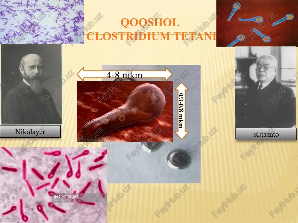 atsiya oʼtkaziladi. biologik sinama: oq sichqonga toksinni antitoksin bilan qoʼshibyuboriladi, neytrallash usuli profilaktikasi oʼz vaqtida bemorga jarrohlik yordami koʼrsatiladi, soʼng cl.perfingens, cl.novyi, cl.septicum larga qarshi polivalent antitoksin zardob “diaferm 3” yuboriladi. image5.jpeg image6.jpeg image7.jpeg image8.jpeg image9.jpeg image10.jpeg image11.jpeg image12.jpeg image13.jpeg image14.png image15.png image16.png image17.jpeg image18.jpeg image19.png image20.jpeg image21.jpeg image22.jpeg image23.jpeg image24.jpeg image25.jpeg image26.jpeg image27.jpeg image28.jpeg image29.png image30.jpeg image31.jpeg image32.jpeg image33.jpeg image34.jpeg image35.jpeg image36.jpeg image37.jpeg image38.jpeg image39.jpeg image40.jpeg image41.jpeg image42.jpeg image43.jpeg image44.jpeg image45.jpeg image46.jpeg image47.jpeg image48.jpeg image49.jpeg image50.jpeg image3.jpeg as croxéussmnsit anaroxeun huynmuponannan somath — houynnas lomasunas chinoporka (croagassuetit anthtokchs) 3ammmenmssii nannent clean wound gangrenous wound rrowdrplugs . templates for powétpoi it ; ~ tn) shg eee q = 8 s fa} g as & co g 5 8 /docprops/thumbnail.jpeg pumjeyy easysopi.or, isdmhs¥l varolvhosvtva lisa¥l tividaal¥.97.00 ¥nsonvd t1z¥d “tohsood ‘lo7n.dhswicattviny-z