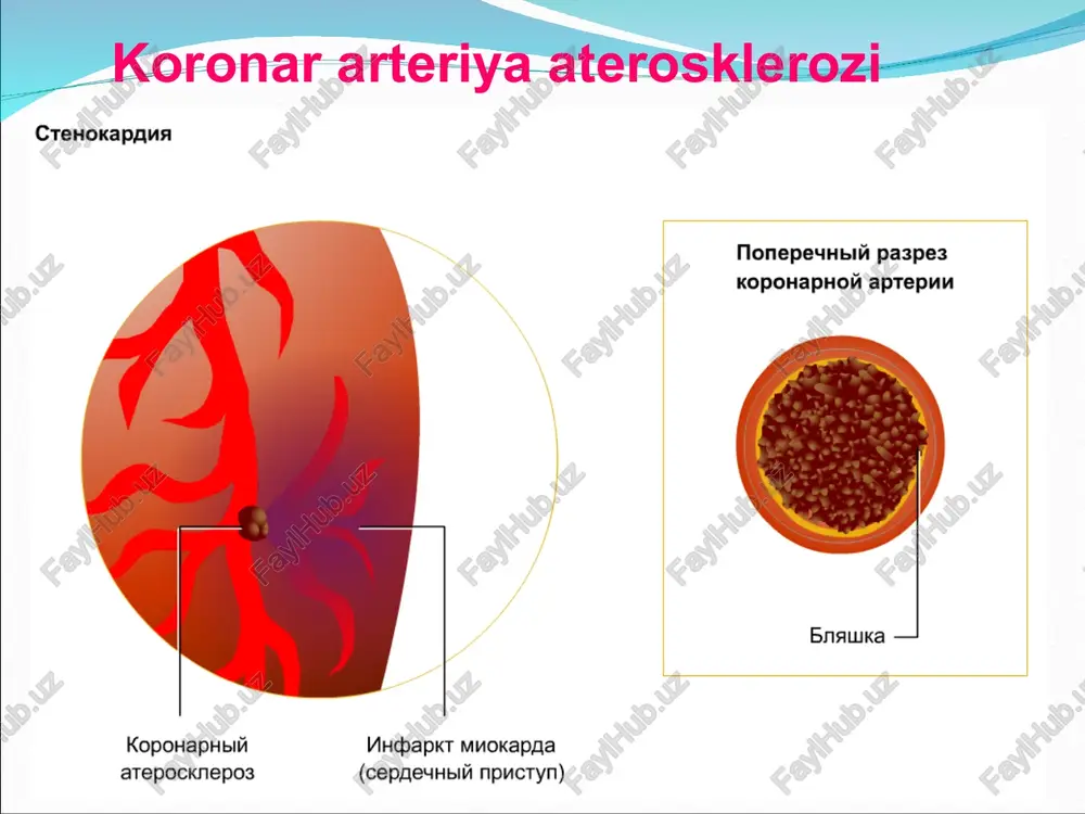 n keyin kolmasa, uni nitroglitserin bilan almashtirish kerak. betta adrenoblokator- lar beta-blokatorlar -adrenoblokatorlar 1-adrenoretseptorlar blokadasi: yurak qisqarishlar chastotasi va kuchini kamayishi –miokardning kislarodga ehtiyojini kamayishi 2-adrenoretseptorlar blokadasi : zararlanmagan koronar tomirlar tonusining ortishi- ishemiyaga uchragan zonalarga konni qayta taqsimlanishi vertae ! 2 -blokatori 2-adrenoretseptorlar blokadasi: zararlanmagan koronar tomirlar tonusining ortishi- ishemiyaga uchragan zonalarga qonni qayta taqsimlanishi anaprilin yurakning β1- adrenoblokatorlarini bloklab, uning tezligini, kuchini, kiskaruvchanligini, kislorodga extiyojini kamaytiradi, arterial kon bosimini pasaytiradi yurak nagruzkasi engillashadi. yurakning ishemiya kasalligida kullanganda stenokardiya xurujlari kamayadi xamda nitroglitserinni kullashga extiyoj xam kamayadi. anaprilin betta adrenomimetik ta'sir etuvchi moddalar nonaxlozin toj tomirlardagi β– adrenoretseptorlarni kuzgatib, ularni kengaytiradi. yurakning β– adneronetseptorlarini kuzgutib, kiskarish kuchini oshiradi, yurakning kon, kislorod bilan ta'minlanishi yaxshilanib boradi. nonaxlozin fenotiazin unumlaridan bulgani uchun markaziy nerv sistemasini ozrok bulsa xam tinchlantiradi xamda aritmiyaga karshi ta'sir etadi. u stenokardiya xurujlarini davolashda , stenokardiya xurujlarining oldini olish uchun kullanadi. kaltsiy kanallarini falajlovchi moddalar ca2+-kanal blokatorlari …