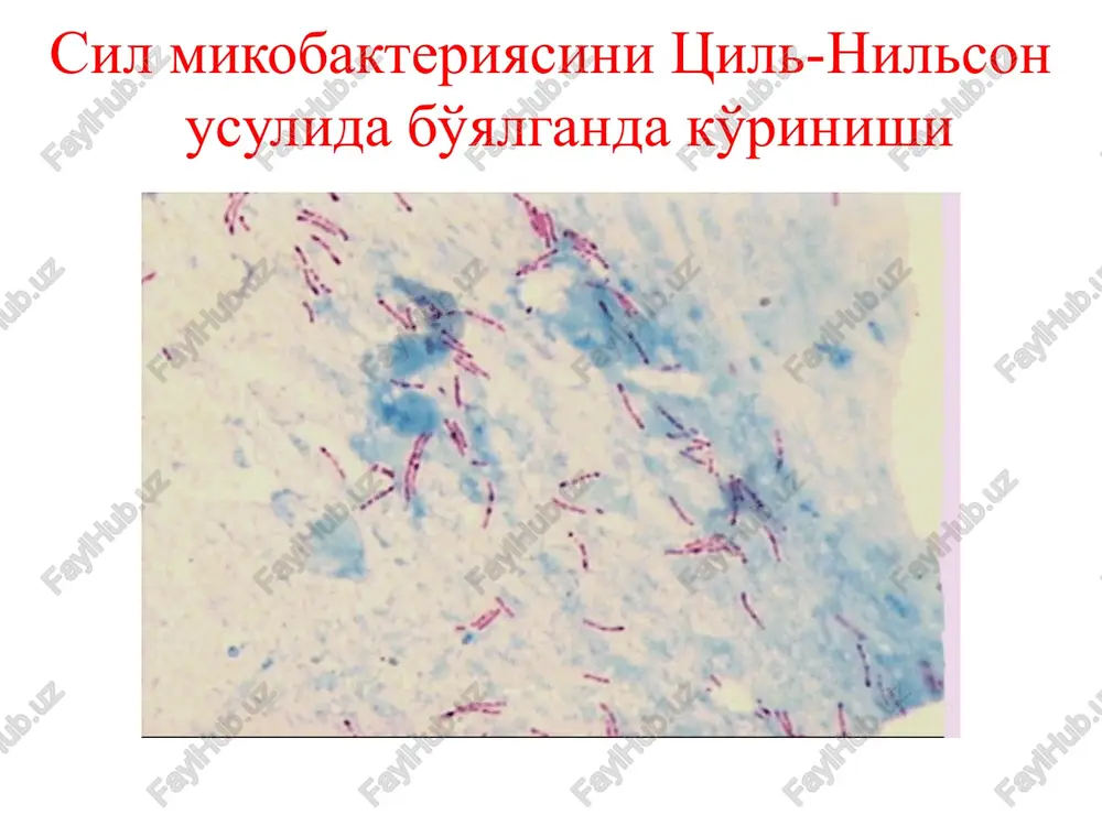 turuvchi diagnostik va davolovchi tekshiruvlarga bo'linadi. hozirgi vaqtda bronxoskopiyani fibrobronxoskop yordamida umumiy narkoz va miorelaksantlar bilan hamda mahalliy og'riqsizlantirish usulida amalga oshirish mumkin diagnostik bronxoskopiyaga asosiy ko'rsatmalar: -traxeya va bronxlar silining klinik belgilari mavjud bo'lganda; -traxeobronxial daraxtdagi nospetsifik yallig'lanishning klinik belgilari bo'lganda; -sil mikobakteriyalari ajralishining noaniq o'chog'ini topishda; -qon tuflash va qon ketishda; -«shishgan» yoki «yopilgan» kavaklar, ayniqsa «suyuqlik sathi» ni aniqlashda; -jarrohlik muolajasi yoki sun'iy pnevmotoraks qo'yishdan oldin; -operatsiyadan keyin bronx cho'ltog'ining holatini aniqlash va reviziya qilish; -noaniq kasalliklarda; -traxeobronxial daraxtni dinamikada kuzatishda (ilgari traxeya va bronxda sil, nospetsifik endobronxit aniqlangan bemorlar); -operatsiyadan keyingi atelektazlarda; -traxeya va bronxlardagi yot jismlarni topishda. bronxoskopiyaga moneliklar mutlaq moneliklar: -yurak-tomir tizimi kasalliklari: aorta anevrizmasi, yurak nuqsoni dekompensatsiya bosqichida, o'tkir miokard infarkti; -nafas etishmovchiligining 3 bosqichi; -uremiya, shok, bosh miya yoki o'pka tomirlari trombozi. bronxoskopiya — edinstvenniy na segodnyashniy den metod, pozvo- lyayushiy: vizualno issledovat sostoyanie vnutrenney poverxnosti traxei, bronxov vplot do subsegmentarnix i …