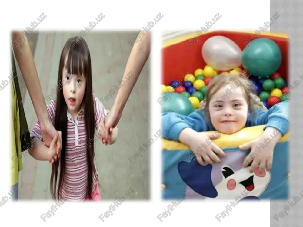 sa. ogmuounas cknagka ha nagoun ("o6e3bahba”) ykopouehhbiii natbii naneu, ve qo nobephytbiit bhytpb. ¥ | je 83 ee ae | * % ny janeko orcrasnenhbiii gonbwor naney w pa3zbutbie koxkhbie ckmaakh ha ctymhe. pe6éhok c cuhppomom jlayha /docprops/thumbnail.jpeg daun sindromli bolalar