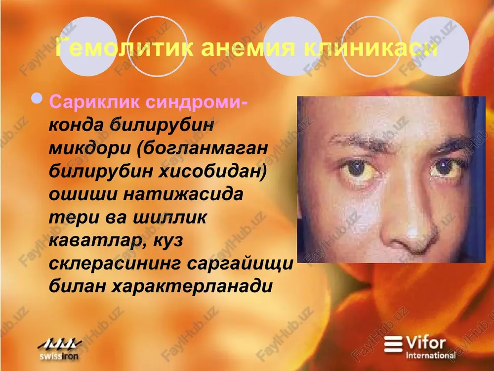 hmaiihmhr sickkh foxopvra = aputpoutnapaa >xownaluybh, yaura xoc twlunaphahe mopdonoruk hotytppm ycklum, ysrapu tanlokhwht spta nemes kattanauwulwv, 6ynagu.(mukpoc tehrkypnapura cbepouvtos huc6atah ycvuujah optaa konimluu. srapvuniap liutapp onmtmi ihemm 0, aabpu lap bal yan alp ounah xalpalkt cpa > oe © 9 es “se . ances eee ee rt ooo. aq ° ; re] 95296, 190.9. veo 209 ee) so oe 9 @ 3 2 = 3 & 2 = a-tanaccemnua — b-tanacemnua — @- 3ahkmp chhtesnahnin b- 3a-dkup cmhte3u 6ysunagn. 6y3unagu 4 xun typ cbapknanagn 2 ta typuv cbapknanagu ot: ae rs > eo) of oe ee @ © » 1 ele c3 qo eo. why) ' ‘s, ») omg oe = y ror. % ¢ te bananannkka kytapunranga ornp runokena 6ynnwin kacannuk ehrun mymkmh temonutk kpus nawtuga kohaa remorno6uh key gunah mmkaoph kaman, xapaktepnahagu. sputpokapvountnap, ypokcmmoh sputpoumtnap ahmknahaan ss remornoguho nattua bab3u 6emopnapyza cnohtah rematypua (6yipak teteposurot hbs tomupnapuunnhdapktu …