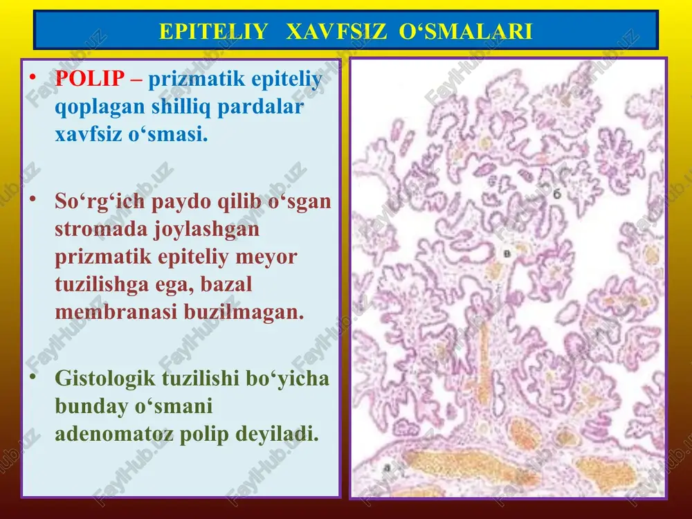epitelial va mezenximal o’smalar - Page 4