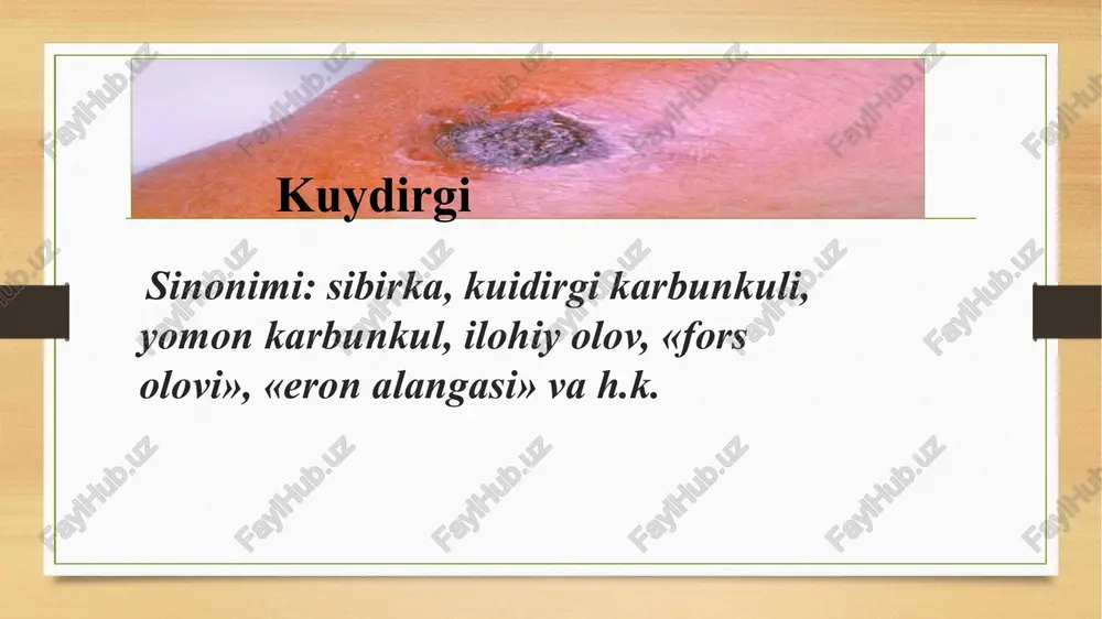 xastalik tez boshlanadi, bemorda shamollash belgilari, ko’krak qafasida o’tkir oʻg’riq paido bo’ladi, nafas olishi qiyinlashadi, qon tbosimi pasaidi. yurak urishi tezlashadi, balgʻamda qon paido bo’ladi. xastalik 2-3 kun davom etishi mumkin. ichak shakli kuidirgining ichak shakli umumiy zaharlanish, tana haroratining ko’tarilishi, qorinda o’tkir ogʻriq paido bo’lishi, ko’ngil aynishi, qon aralash qusish va ich ketishi bilan xarakterlanadi. bemorning ahvoli tezda ogʻirlashishi va kasallik o’lim bilan tugaydi. ogʻiz-halqum shakli ogʻiz-halqumni yarali-nekrotik zararlanishi bo’yindagi yaqqol shish, kipincha bir tarafli tashhisoti kuydirgi kasalligining klinikasi alomatlari, bemordan olingan epidemiologiya anamnez va laborator tekshiruvlari natijalariga asoslangan holda qo’yiladi. kuidirgi kasalligining laboratoriya diagnostikasi: bakteriologik bakterioskopik biologik molekulyar genetik (pzr) kuidirgida bemordan olinadigan namunalar: teri shakli o’pka shakli ichak shakli ogʻiz-halqum shakli meningeal shakli pufarchalar ichi, yara tubi yoki qora qo’tir chetidan surtma, punksiyonal biopsiya balʼam (tomoqdan surtma), qon, plevral suyuqlik axlat, qusuq, qon, assitik suyuqlik qon, tomoqdan surtma, balʻam orqa miya suyuqligi, qon davolash kuidirgini teri (yarali) …
