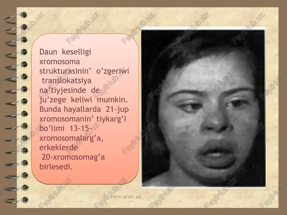 daun sindromi - Page 4