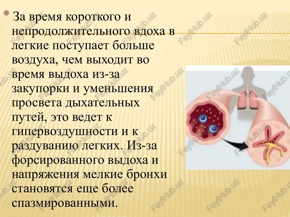 5% glyukozi. vse bolnie s astmaticheskim statusom nezavisimo ot rezultatov lecheniya na dogospitalnom etape podlejat gospitalizatsii. pri astmaticheskom statuse iii stadii ves rekomendovanniy kompleks lechebnix meropriyatiy osushestvlyaetsya odnovremenno, snachala v domashnix usloviyax, a zatem — v protsesse transportirovki bolnogo v statsionar. pervaya vrachebnaya pomosh pri astmaticheskom statuse okazivaetsya tolko «skoroy pomoshyu», jelatelno — spetsializirovannimi brigadami. image3.jpeg image4.jpeg image5.jpeg /docprops/thumbnail.jpeg actwanisecxuii cratye