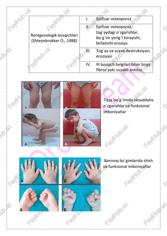 yuvenil revmatoid artrit (yura) - Page 4