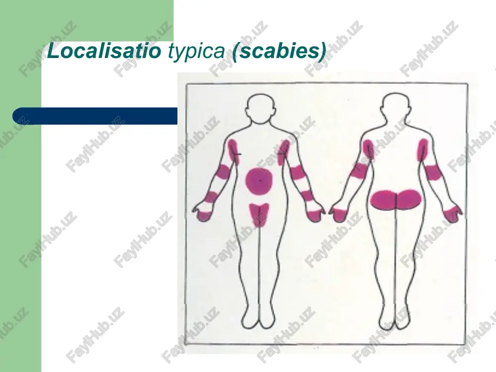 chesotka (scabies) - Page 4