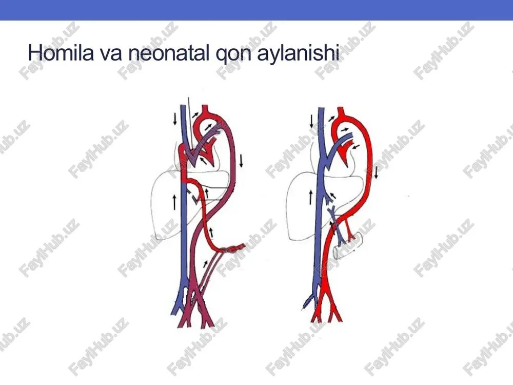 uqsonlarining tarkibiy qismi sifatida ala+vsd vsdsiz ala o'ng qorincha chap qorincha aorta arterioz kanali o'pka arteriyasi pankreasdan o'pka arteriyasiga o'ng atrium patent foramen ovale chap atrium chap qorincha aorta arterioz kanali o'pka arteriyasi arterial gipoksemiya o'ng qorincha etishmovchiligi auskultativ tovushlar siyanoz nafas qisilishi gepatomegali pastki ekstremitalarning shishishi kamchilikning mumkin bo'lgan afonik rasmi sistolik yoki sistolik-diastolik shovqin sternumning chap tomonida, orqa tomonga o'tkaziladi diagnostika: - echo-kg vsd ning vizualizatsiyasi o'pka arteriyasining klapan, magistral yoki shoxlari orqali qon oqimining etishmasligi ko'tarilgan aortaning kengayishi - yurak kateterizatsiyasi va angiokardiografiya - ko'krak qafasi rentgenogrammasi o'pka naqshining kamayishi kardiyomegali o'pka arteriyasi yoyining orqaga tortilishi 17 tetrad fallot qusurning rivojlanishi o'ng qorincha infundibulyar qismining rivojlanmaganligiga asoslanadi. 4 ta komponent : - vsd - aortaning dekstrapozitsiyasi - oshqozon osti bezi chiqish yo'llarining obstruktsiyasi - rv gipertrofiyasi - tf ning rangpar shakli - klassik tf shakli - o'pka atreziyasi bilan tf - o'pka qopqog'ining yoshi bilan tf barcha …