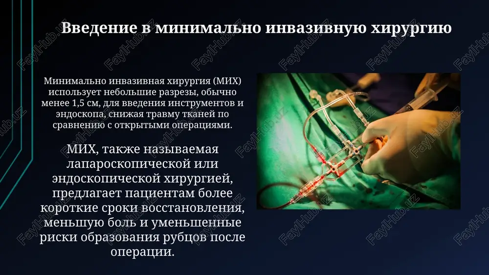 torakoskopicheskaya xirurgiya - Page 4
