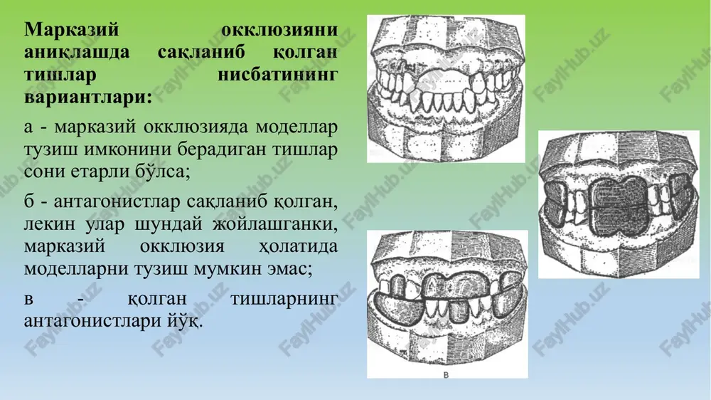 yoki sifatsiz metallni qo'llash. olingan karkas allergik xususiyatlari va qattiqligi bo'yicha talablarga javob bermaydi va uni qayta ishlashga to'g'ri keladi. oshibki pri postanovke zubov oni proyavlyayutsya na etape proverki konstruktsii proteza; oshibki pri otdelke i polirovke proteza pri etom mojet voznikat polirovochniy ojog. on izmenyaet strukturu metalla ili plastmassi, oplavlyaet plastmassu, delaet ee bolee tonkoy. image1.png image2.png image3.png image4.png image5.png image6.png image7.png image8.png image9.png image10.png image11.png image12.png image13.png image14.png image15.jpeg image16.jpeg image17.jpeg /docprops/thumbnail.jpeg