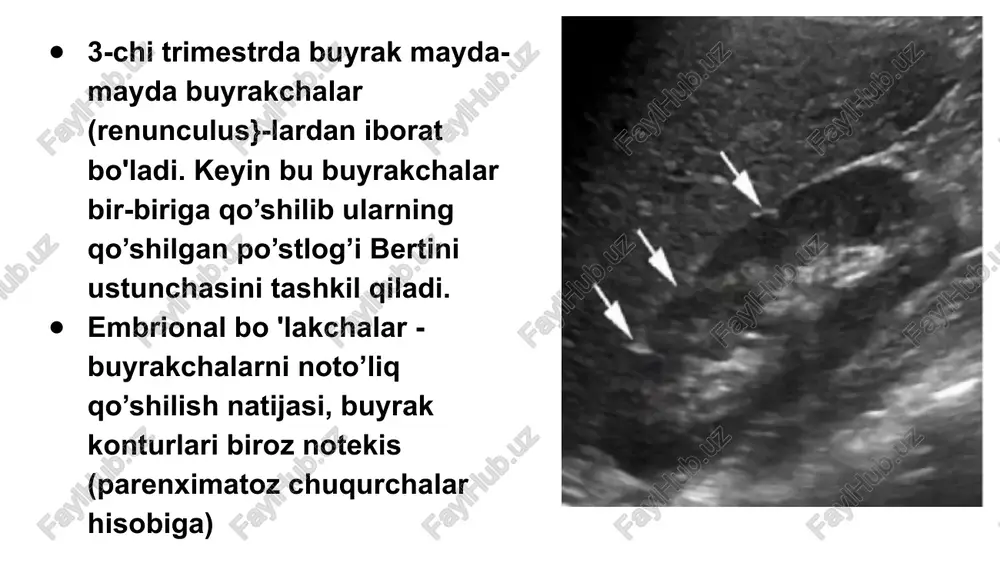 ultratovush tekshirish usuli - sonografiya - Page 4