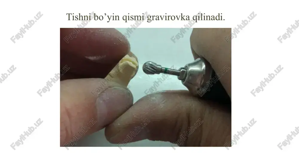 olinmaydigan tishprotezlari bilan protezlash - Page 4