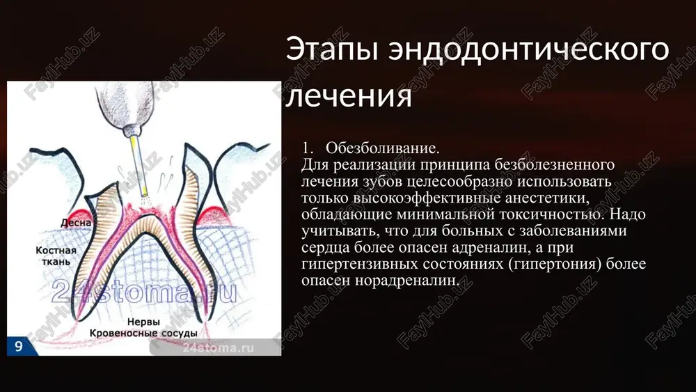 n-26, ah-plus; 14 4) materiali na osnove rezortsin-formalina: rezortsin-formalinovaya pasta, forfenan (firma septodont), rezodent (ao vladmiva); 5) guttapercha, termafil (firma dentsply). posle plombirovaniya kanalov neobxodimo sdelat kontrolnuyu rentgenografiyu, chtobi ubeditsya, chto kanali zaplombirovani na vsem protyajenii. plombirovat sleduet do fiziologicheskogo apeksa s posleduyushey rentgenografiey, konstatiruyushey kachestvo zapolneniya kornevogo kanala zuba. 15 10. postanovka postoyannoy plombi dlya restavratsii depulpirovannix zubov rekomenduetsya ispolzovat kompozitnie plombirovochnie materiali, pozvolyayushie vosstanovit zub kak polnotsenno funktsioniruyushiy organ na dolgie godi. 16 nedostatki devitalizatsii pulpi umenshenie prochnosti zuba udalenie pulpi oslablyaet zub, uvelichivaya risk pereloma. povrejdenie periodonta proniknovenie infektsii v tkani, okrujayushie zub, mojet privesti k ix vospaleniyu. risk vtorichnogo kariesa iz-za izmeneniya mikroflori polosti rta, posle devitalizatsii vozrastaet risk razvitiya vtorichnogo kariesa. 17 alternativnie metodi lecheniya pulpita bez devitalizatsii vitalnaya ekstirpatsiya udalenie tolko porajennoy chasti pulpi s soxraneniem zdorovoy. biopunktura ispolzovanie spetsialnix igl dlya stimulirovaniya zajivleniya pulpi. lazernoe lechenie primenenie lazera dlya udaleniya porajennix tkaney pulpi. …