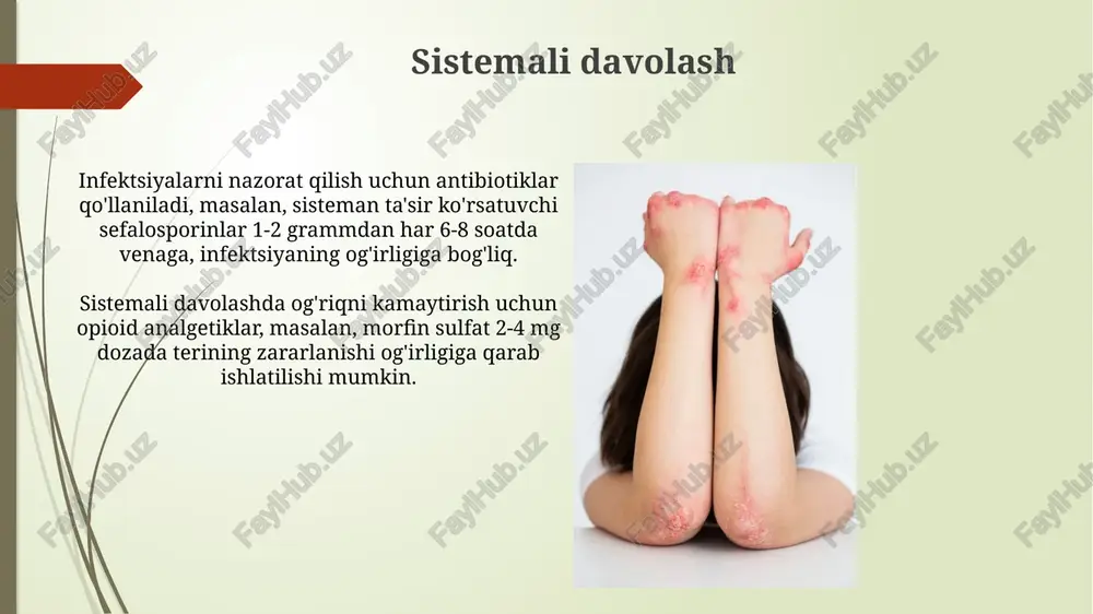 shga yordam beradi, kontrakturani kamaytiradi va erta bosqichda erta harakatlarni rag'batlantiradi. psixologik yordam psixologik yordam erta bolalikdagi travmatik tajribalarni hal qilishga yordam beradi, bu esa kattalar hayotida 60-70% hollarda ruhiy muammolarni kamaytiradi. guruhli psixologik yordam 5-10 kishilik guruhlarda o'tkazilib, ijtimoiy ko'nikmalarni rivojlantirishga va izolyatsiyani kamaytirishga yordam beradi, bu esa 30-40% gacha ijobiy o'zgarishlarga olib keladi. so'nggi tadqiqotlar va yangi davolash usullari o'zak hujayralar terapiyasi eb og'ir shakllari uchun umid beruvchi, suyak ko'migidan olingan o'zak hujayralarini kiritish orqali kollagen vii ishlab chiqarish 40% ga oshiriladi. yangiliklardan biri filaggrin oqsilini kuchaytiradigan mahalliy malhamlar, bu terining to'siq funksiyasini yaxshilaydi va pufakchalar hosil bo'lishini 30% ga kamaytiradi, tadqiqotlar davom etmoqda. e'tiboringiz uchun rahmat image2.jpg image3.jpg image4.jpg image5.jpg image6.jpg image7.jpg image8.jpg image9.jpg image10.jpg image11.jpg image12.jpg image13.jpg image14.jpg image15.jpg image16.jpg image17.jpg image18.jpg