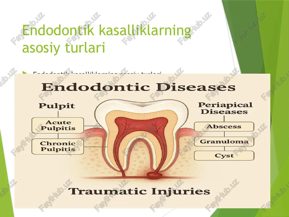 l ichidagi bakteriyalarni o‘ldirish va kanalni dezinfeksiya qilish uchun ishlatiladi (masalan, natriy gipoklorit, xlorheksidin). xulosa: endodontik davolash tish sog‘ligini saqlash, og‘riqni kamaytirish va og‘ir asoratlarning oldini olishda muhim ahamiyatga ega. kemik va kimyoviy preparatlar esa davolash samaradorligini oshiradi. minimal invaziv yondashuv endodontik davolash ahamiyati va minimal invaziv yondashuv – natija: endodontik davolash tishning infeksiyalangan yoki zararlangan pulpini saqlab qolish va og‘riqni bartaraf etishda muhim rol o‘ynaydi. minimal invaziv yondashuv esa tish to‘qimasini maksimal darajada saqlab, tabiiy strukturasini himoya qiladi, davolash jarayonini soddalashtiradi va postoperativ asoratlarni kamaytiradi. shu bilan birga, bu usul tishning uzoq muddatli funksiyasini va estetik ko‘rinishini ta’minlashga yordam beradi. natriy gipoklorit (naocl) endodontik davolash — bu tish ildizi kanallaridagi kasalliklarni davolash usuli bo‘lib, u tishning tabiiy tuzilishini saqlash va og‘riqni kamaytirish uchun muhimdir. kanal ichidagi infeksiyani bartaraf etish, nekrotik to‘qimalarni olib tashlash va mikrobiyal faoliyatni bostirish orqali tish sog‘lom holatga qaytariladi. natriy gipoklorit (naocl) natriy gipoklorit — endodontik …