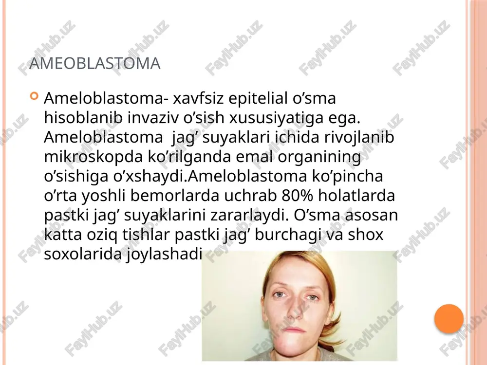 ikulyar kistalar follikulyar kistalar hali yorib chiqmagan tishning emalidan rivojlanadi. kista ko’proq pastki uchinchi molyar, qoziq va yuqori jag’dagi uchinchi molyar tishlarda hosil bo’ladi. kistaning klinik ko’rinishi jag’da uchraydigan boshqa kistalarnikiga o’xshab ketadikista soxasida tish ko’rinmaydi tish saqlovchi kistalarda ameloblastomalar kelib chiqishi mumkun rentgen tekshiruvida suyakning aniq chegarali yemirilgani ko’rinadi kista bo’shlig’ida to’liq shakllangan retensiyali sababchi tish aniqlanadi.uning toj qismi kista bo’shliqiga qaragan yoki uning devoriga tegib turishi mumkun gemangiomalar gemangioma – xavfsiz, chegaralanmagan qon tomirlarining proliferatsiyasidan hosil bo’luvchi o’smasidir. kelib chiqishi noma’lum bo’lib ko’pchilik tadqiqorchilar gemangiomalarni qon tomirlarining anomaliyasi deb hisoblaydi. lekin gemangiomalarning bir qismi haqiqiy o’smalarga kirsada , ularni bir-biridan ajratish juda qiyin.gemangiomalar ko’pincha tug’ma bo’lib, organizm o’sgan sari ular ham kattalashib boradi, bazida esa to’qimalar orasida joylashib mutlaqo sezilmaydi yoki kech seziladi.gemangioma infiltrativ o’sib atrof to’qimani yemiradi va kamdan kam hollarda xavfliga aylanadi. yosh bolalarda gemangioma yoq bolib ketishi ham mumkun. kapillyar gemangiomalar ko’pincha lunj, ko’z osti …