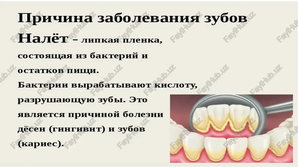 gii. postoyannie zubi ne podverjeni obrazovaniyu naleta pristli. vne zavisimosti ot vozrasta rebenka, poyavlenie temnix pyaten na emali trebuet nezamedlitelnogo obrasheniya k stomatologu, kotoriy viyasnyaet prichinu nepriyatnix simptomov i naznachaet sootvetstvuyushee lechenie. chto takoe nalet pristli na zubax i kak ego vovremya obnarujit? nalet pristli formiruetsya na zubax rebenka v rezultate jiznedeyatelnosti opredelennix bakteriy. v otlichie ot obichnogo naleta, on imeet cherniy ili temno-korichneviy tsvet, inogda s belesim ili perlamutrovim otlivom. patologiya mojet bit kak predstavlena otdelnimi pyatnami ili poloskami, tak i pochti polnostyu pokrivat emal. naibolee chasto stradaet vnutrennyaya poverxnost zubov, reje – mejzubnie promejutki. v samix redkix i tyajelix sluchayax nalet formiruetsya na peredney poverxnosti zubnogo ryada. v zavisimosti ot sostoyaniya zdorovya rebenka, patologiya mojet poyavlyatsya postepenno, porajaya nebolshie uchastki emali, ili zaxvativat znachitelnuyu ploshad bukvalno za 1-2 dnya. chashe eto proisxodit vo vremya snijeniya immuniteta, naprimer, na fone orvi. obrazovanie otlojeniy soprovojdaetsya poyavleniem nepriyatnogo zapaxa izo rta, …