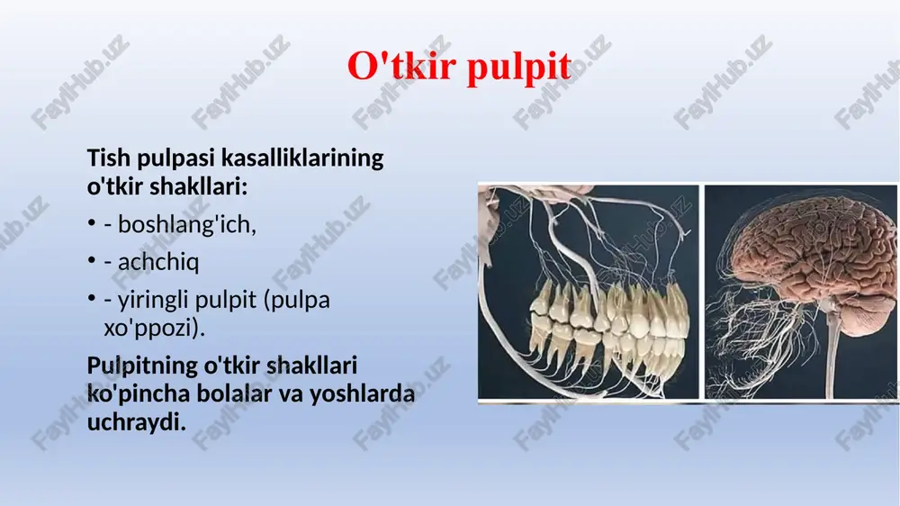 an zondlash yallig'langan pulpa shoxining proektsiyasida og'riqli, odp bilan - butun pastki bo'ylab; - perkussiya oopda og'riqsiz, odpda og'riqli; - oopda eod - 20 mka gacha, odpda - 30-45 ma. umumiy: - barcha turdagi tirnash xususiyati beruvchi og'riqlar; - o'z-o'zidan og'riq, ayniqsa kechasi; - chuqur karioz bo'shliqning mavjudligi; - tish bo'shlig'i ochilmagan. o'tkir fokal (af) va surunkali fibroz pulpit (sfp) ning differentsial diagnostikasi farqlar: - oop bilan o'z-o'zidan og'riq paydo bo'ladi, cfp bilan faqat pulpa yallig'lanish jarayoni yomonlashganda; - oop holatida (travmatikdan tashqari) karioz bo'shliq va pulpa kamerasi o'rtasida aloqa yo'q, nekrektomiyadan keyin cfp bo'lsa, odatda aniqlanadi; - oopda eod - 20 mka gacha, hfpda - 35-40 ma; - oop anamnezida cfpdan farqli o'laroq, o'tmishdagi spontan og'riqlar aniqlanmaydi. - ochp 1-2 kun, hfp esa bir necha yilgacha mavjud. agar profilaktik davolanish paytida pulpit aniqlansa, u odatda surunkali bo'ladi. umumiy: tirnash xususiyati beruvchi, ayniqsa sovuqdan kelib chiqqan uzoq muddatli og'riq; karioz …