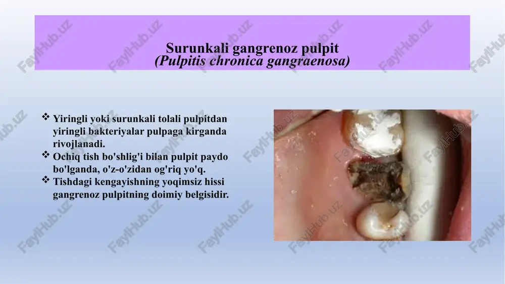 jada tashkil etilgan): erkin, parietal, interstitsial; -soxta (past tashkil etilgan); b) toshlanish 3) tish bo'shlig'i va ildiz kanallarining obliteratsiyasi. tishlar tug'ilmagan sut va doimiy tishlarda, hatto embrionlarda ham topilgan. tishlarni aniqlash chastotasi 39,9-53,9% ga etadi 16 yoshgacha bo'lgan bolalarda bu ko'rsatkich faqat 4,4% ni tashkil qiladi (doimiy tishlarning pulpasida). birlamchi molarlarda kalsifikatsiyaning tarqalishi haqidagi ma'lumotlar yuqori o'zgaruvchanlik bilan tavsiflanadi. petrifikatsiyalar kalsifikatsiya joylari bo'lib, odatda nerv tolalari va tomirlarining periferiyasi bo'ylab ildizda, shuningdek, ikkinchisining devorida joylashgan. ba'zida tish pulpasida ohak tuzlarining diffuz cho'kishi aniqlanadi - pulpaning toshlanishi (pulpa konkrementozi), uning paydo bo'lishi ildiz pulpasining hayotiy faoliyatining pasayishiga qarab tuz almashinuvidagi mahalliy buzilishlar bilan bog'liq. ba'zi xorijiy mualliflar perivaskulyar va perineural joylashgan ildiz va koronal pulpaning minerallashgan joylarini bildirish uchun "distrofik kalsifikatsiya" atamasidan foydalanadilar. pulpa kalsifikatsiyasining paydo bo'lishining mumkin bo'lgan etiologik omillari: 1. tish to‘qimalarining hosil bo‘lishining irsiy buzilishlari - amelogenez, nomukammal dentinogenez, imperfekta osteogenez, dentin displazi, stanton-capdepont sindromi, marmar kasalligi (osteopetroz); …