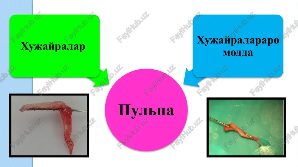 chi rami dentalis aa. alveolaris inferior orqali ta'minlanadi. tish pulpasining innervatsiyasi: nerv tolalar tutami arterial tomirlar bilan birgalikda kelib tishning tomir-nerv tutamini xosil qiladi; odontoblastlar soxasining ichki tomonida subodontoblastik nerv tutami (rashkov tutami) bo'ladi. nerv impulsini o'tkazuvchi mielinli nerv tolalari – og'riq va taktil signallarni qabul qilishda qatnashadi. mielinsiz nerv tolalari – simpatik tizimga ta'luqli bo'lib hisoblanadi. bunday nerv elementlari frontal guruhdagi tishlarda chaynov tishlarga nisbatan ko'p uchraydi sudodontoblastik nerv tutami pulpaning funktsiyalari: plastik – dentinni hosil bo'lishida ishtirok etadi (odontoblastlar hisobiga) trofik – qon va limfa bilan ta'minlanishi hisobiga. himoya yoki barer – ildiz kanal orqali periodontga infektsiya o'tish uchun biologik to'siq bo'lib, undagi xujayralar ximoya vazifasini bajaradi. odontoblastlar pulpani plastik funktsiyasini bajarishda ishtirok etishadi. ular tufayli tish yorib chiqqungacha birlamchi dentin xosil bo'ladi. tish chiqqandan so'ng, birlamchi dentin tuzilishiga o'xshash ikkilamchi dentin shakllanadi. ikkilamchi dentin sintezlanishi doimiy ravishda bo'ladi. shuning uchun vaqt o'tgan sari tish bo'shlig'i kichrayib boradi. …