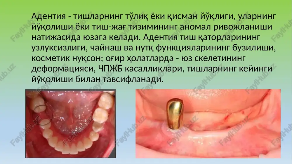 a shilliq qavatning harakatchanligini va og'iz dahlizi chuqurligini tekshirish. ii. instrumental usullar 1. funktsional bosim indikatorlari - gerbst plastinkalari, mumli valiklar. 2. optik tasvirlash - lupalar, mikroskoplar. usullar tasnifi: iii. apparat usullari 1. rentgenografiya (ortopan) - alveolyar qirraning balandligi va shaklini panoramali baholash. 2. nishonli rentgenografiya - suyak to'qimasi sohasini batafsil baholash. 3. kt (cbct) - suyak to'qimasi hajmi va anatomiyasini uch o'lchovli baholash. 4. elektromiografiya - chaynov mushaklari ishini baholash. 5. pezometriya - shilliq qavat elastikligini aniqlash. 6. termografiya - to'qimalar haroratiga qarab yallig'lanish jarayonlarini aniqlash. 7. fotohujjatlashtirish - dinamikada holatni qayd etish. iv. maxsus namunalar 1. shiller-pisarev sinamasi - muguzlangan va yallig'langan joylarni bo'yash yo'li bilan aniqlash. 2. to'qimalar chidamliligi sinamasi - vaqtinchalik bazis qo'yish va shilliq qavatning yuklamaga reaktsiyasini baholash. image1.png image2.png image3.png image4.png image5.png image6.jpeg image7.png image8.png image9.png image10.jpeg image11.png image12.png image13.png image14.jpeg image15.png image16.png image17.png /docprops/thumbnail.jpeg