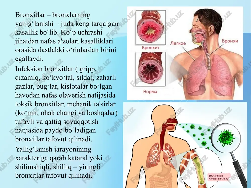 eksion kasallik bo‘lib o‘pkaning butun bo‘lagi (yoki uning segmentlari) zararlanishi, sikl bilan kechishi va ko‘pincha jarayonga plevra tortilishi bilan xarakterlanadigan o‘pka parenximasining o‘tkir yallig‘lanishidir. etiologiya va patogenez: 90% pnevmokok, stafilokok, gemolitik, streptokok bilan chaqiriladi. simptomlari: kasallik o‘tkir et uvishishidan boshlanib (39s- 40s), ko‘krak va yonboshda og‘riqlar paydo bo‘ladi, yo‘talish va aksirganda kuchayadi. qattiq bosh og‘rig‘i, tashnalik kuchayadi. boshida balg‘am biroz tiniq, yopishqoq, ajralishi qiyinlik bilan kechadi, 2-kuni zangsimon tus oladi. lablarda seroz toshmalar (hegres) aniqlanadi, yuzaki nafas olish, uyqu buziladi, hansirash, pul'sning tezlashishi kuzatiladi. krupoz pnevmoniya bilan kasallanish odatda bahor va kuz fasllarida, ya'ni havo harorati keskin o‘zgarib turadigan davrda ko‘payadi. sovuq qotish, uzoq vaqtgacha och qolish, asabiy zo‘riqish, tamaki chekish, ichkilikni suiste'mol qilish, kasb-korga aloqador zararli ta'sirlar, nafas yo‘llarining o‘tkir va surunkali kasalliklari, kichik qon aylanish doirasida dimlanish va boshqalar kasallik kelib chiqishiga sabab bo‘ladi. xastalik odatda birdan boshlanib, umumiy lohaslik paydo bo‘ladi, odam qaltiraydi, darmoni qurib, badani terlaydi, …