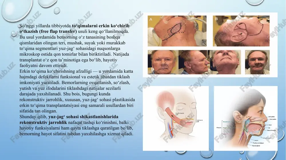 minlaydi. jag‘ suyaklari o‘z navbatida yuzning shaklini, simmetriyasini va tashqi estetik ko‘rinishini belgilovchi asosiy tuzilmadir. yuz sohasida joylashgan mimik mushaklar insonning his-tuyg‘ularini ifoda etishda muhim rol o‘ynaydi. ular teriga bevosita birikkan bo‘lib, har xil harakatlar — kulish, qovog‘ini solish, lablarni qisish yoki ko‘z qisish kabi mimik reaktsiyalarni ta’minlaydi. shu sababli, ushbu mushaklarning shikastlanishi yoki tiklanmagan holatda qolishi bemorning psixologik holatiga ham salbiy ta’sir ko‘rsatadi. yuz-jag‘ sohasining anatomik va funksional xususiyatlari yuz-jag‘ sohasi qon tomir tarmoqlari jihatidan ham juda boy. asosiy arteriyalar — a. facialis, a. maxillaris va a. temporalis superficialis, ular soha to‘qimalarini kislorod va oziqa moddalari bilan ta’minlaydi. bu qon tomirlar rekonstruktiv jarrohlikda donor va qabul qiluvchi tomir sifatida eng ko‘p ishlatiladi. shuningdek, asabbop ta’minot ham yuz-jag‘ sohasida o‘ta muhimdir. n. facialis (yuz nervi) barcha mimik mushaklarni innervatsiya qiladi, n. trigeminus (uch shoxli asab) esa sezuvchanlikni ta’minlaydi. shuning uchun har qanday jarrohlik amaliyotida ushbu nervlarning saqlanishi transplantatning funksional muvaffaqiyati …