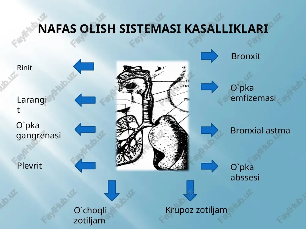 bo’lishi kerak. eshitish simmetrik qismlarda bajarilib, bir-biri bilan solishtiriladi. eshitish joylari. o’pkani eshitganda shovqinni xususiyatiga, kuchiga, joylashishiga, tarqalishiga, nafas davrlariga e’tibor berish lozim. eshitishda avval old tomondan, o’pka uchidan qo’ltiq osti chuqurchasigacha (bemorning qo’li boshi ustida bo’lishi kerak), orqa tomondan kurakning usti, o’rtasi va osti yuzalari eshitiladi. qo`shimcha nafas shovqinlari quruq hirilashlar nam hirilashlar jarangsiz nam hirilashlar jarangli nam hirilashlar kripitatsiya(g`ijirlash) plevraning ishqalanish shovqini palpatsiya palpatsiya. ko’krak qafasini paypaslab, uning kattaligi, shakli haqida ko’zdan kechirishda olingan ma’lumotlarni tasdiqlash, ko’krak qafasidagi og`riq joylarni, ko’krak qafasi elastikligini, rezistentligini, tovush dirillashini aniqlash imkoni tug`iladi. paypaslash orqali yuzaki va chuqur og`riqlarni aniqlash mumkin. yuzaki og`riqlar qovurg`alar aro nerv, muskullar shikastlanganda, qovurg`alar singanida yoki darz ketganida paydo bo’ladi. odatda ko’krak qafasini ikkala yarmi barobar cho’ziluvchanlik (elastiklik) va taranglikka (rezistentlik) ega bo’lib, yosh ortib borishi bilan ular kamayib boradi. cho’ziluvchanlik va taranglikni ko’krak qafasini ikkala yon tomondan siqib aniqlash mumkin. paypaslash ovoz dirillashini aniqlashda ayniqsa qo’l …