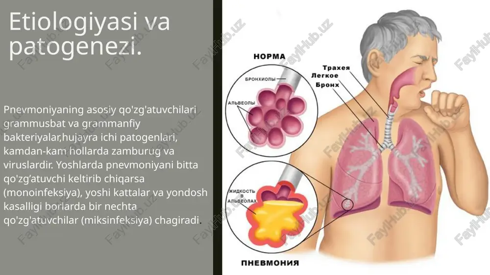 lida bo'yash); ﻿﻿balgamni ekish (antibiotikka sezuvchanligini aniqlash); ﻿﻿umumiy siydik tahlili. laborator-asbobiy tekshirishlar. 2. ko'rsatmalar bo 'iganda solishtirma tashxis o tkazish maqsadida: ﻿﻿- yugori harorat va qaltirash bo lganda gonni ekish; - ﻿﻿ventilyatsiya buzilishida tnni tekshirish; * nafas yetishmovchiligi bo'lgan og'ir bemorlarda gondagi gaz (po, pco,) va kislota-ishqor muvozanatini aniqlash; ﻿﻿- plevra bo*shlig'ida suyuqlik bo'lganda, uni sitologik, biokimyoviy, mikrobiologik tekshirish; - ﻿﻿o'pkada o' sma yoki to qimasida destruksiyaga shubha bo'iganda kt; ﻿﻿- atipik pnevmoniyada serologik (qo' zg' atuvchiga antitanaga aniqlash uchun sinamali tekshirishlar); ﻿﻿- fibrobronxoskopiya - o'smaga shubha bo'iganda, qon tuflash kuzatilganda, pnevmoniya cho zilib kechganda; - ﻿﻿immun holatni tekshirish (immun defitsit va cho' zilib kechgan pnevmoniyaga shubha bo' iganda); - ﻿﻿o'pka sintigrafiyasi o'pka arteriyasi trombo emboliyasiga (o' ate) shubha bo lganda. . laborator-asbobiy tekshirishlar pnevmoniyalarni davolash. . yevropa respirator jamiyati tomonidan quyidagi holatlarda kasalxonadan tashqari pnevmoniyani shifoxona sharoitida davolash tavsiya etilgan (1997): • yoshi 65 katta bemorlar; - surunkali yondosh …