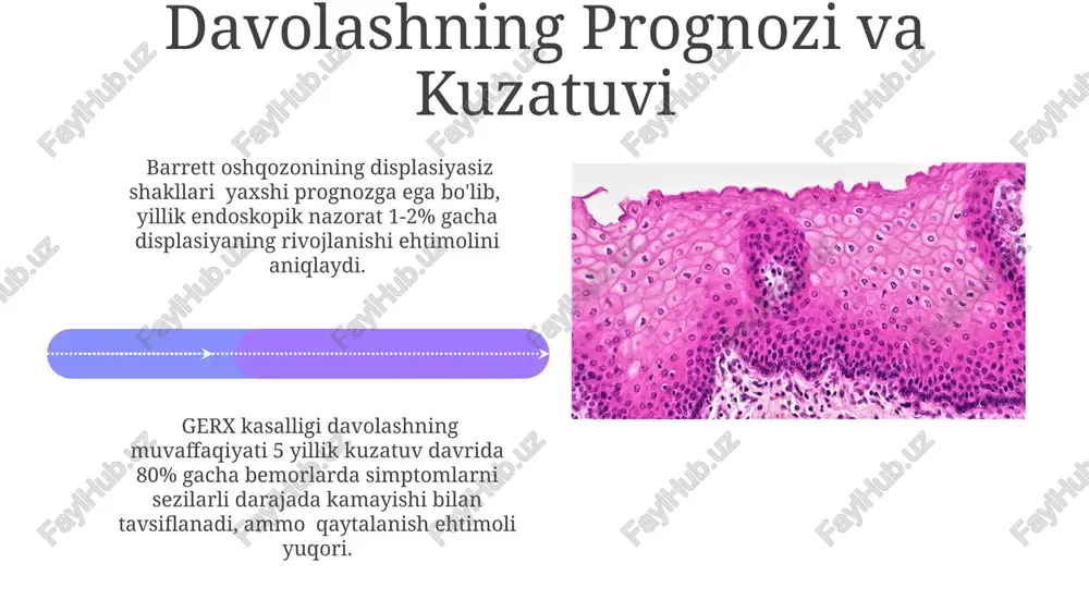 aniqlanadi. ezofagogastroduodenoskopiya (egds) orqali o'tkaziladigan tekshiruv ahalaziya kardiya diagnostikasida muhim rol o'ynaydi va qizilo'ngach devorining kengayishi (diametri 2 sm dan ortiq) va "qush tumshug'i" belgisini aniqlashga yordam beradi. kasalliklarning oldini olish oshqozon-qizilo'ngach reflyuks kasalligining oldini olish uchun kuniga kamida 2-3 marta kichik hajmlarda ovqatlanish, shuningdek, yog'li va achchiq ovqatlar, gazli ichimliklar va kofein miqdorini kamaytirish tavsiya etiladi. chekish gerd rivojlanishiga hissa qo'shadi, shuning uchun chekishni tashlash yoki umuman chekmaslik bu kasallikning oldini olishning samarali usuli hisoblanadi. kuniga 20 dan ortiq sigaret chekish xavfni 3 baravar oshiradi. gerxning alomatlari va diagnostikasi bemorlarning taxminan 10 foizida gerxning asemptomatik shakli kuzatiladi, ya'ni ular hech qanday alomatlarni sezmaydilar, lekin endoskopik tekshiruv o'zgarishlarni aniqlashi mumkin. bu holda muntazam tekshiruvlar muhimdir. gerxning asosiy alomatlaridan biri haftasiga ikki yoki undan ortiq qaytalanuvchi kislota qaytmasidir, bu esa ko'krak qafasida yonish hissi (piroziya) bilan birga keladi. endoskopiya va biopsiya gerxni aniqlashda muhim diagnostika usullaridan hisoblanadi. e'tiboringiz uchun rahmat @taqdimot_robot …