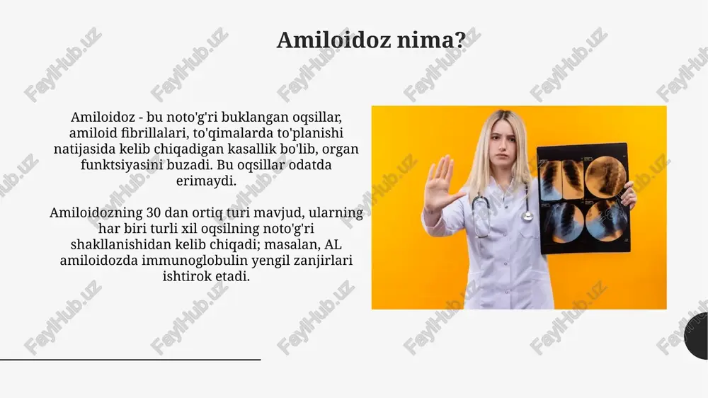 ilan kechadigan buyrak amiloidozining prognozi oqsiluriyaning darajasiga ta'sir qiladi, sutkalik oqsil yo'qotilishi 3,5 grammdan yuqori bo'lsa, natija yomonlashadi. xulosa buyrak amiloidozida nefrotik sindromning oqibatlari bemorning hayot sifatiga jiddiy ta'sir qiladi, shuning uchun erta tashxis qo'yish va kompleks davolash juda muhimdir. davolashning asosiy maqsadi amiloid cho'kindi hosil bo'lishini sekinlashtirish yoki to'xtatish, qonda albumin miqdorini oshirish va shish paydo bo'lishining oldini olishga qaratilgan, bu esa kasallikni nazorat qilishga yordam beradi. e'tiboringiz uchun rahmat image2.jpg image3.jpg image4.jpg image5.jpg image6.jpg image7.jpg image8.jpg image9.jpg image10.jpg image11.jpg image12.jpg image13.jpg image14.jpg image15.jpg image16.jpg image17.jpg image18.jpg