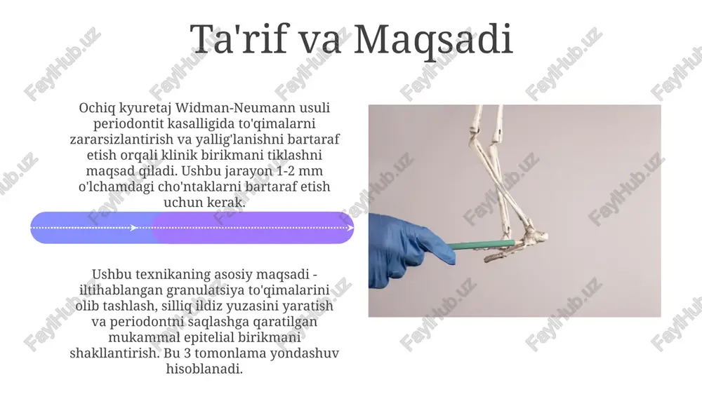eksidin 0,12% eritmasi bilan kuniga ikki marta chayish kerak, bu yallig'lanishni kamaytiradi va mikroblarga qarshi ta'sir ko'rsatadi. asoratlar asoratlar, masalan, qon ketishi 1% dan kam holatlarda uchraydi va odatda mahalliy bosim bilan bartaraf etiladi, og'irroq holatlarda esa tikuv talab etiladi. jarrohlikdan keyingi infektsiyalar, ko'pincha 5% dan kam holatlarda kuzatiladi, antibiotiklar bilan davolanadi; bemorlarga og'iz gigienasini saqlash bo'yicha aniq ko'rsatmalar beriladi. uzoq muddatli prognoz va saqlash uzoq muddatli prognoz, bemorning og'iz gigienasi darajasiga bog'liq; kamida 90% bemorlar 5 yildan ortiq tishlarini saqlab qolishadi, agar gigiena yaxshi bo'lsa. saqlash ko'rsatkichlari 10 yildan keyin 75% dan 85% gacha bo'lishi mumkin, suyak defektining o'lchami va bemorning parvarishi muhim omillardir. e'tiboringiz uchun rahmat image5.jpg image6.jpg image7.jpg image8.jpg image9.jpg image10.jpg image11.jpg image12.jpg image13.jpg image14.jpg image15.jpg image16.jpg image17.jpg image18.jpg image19.jpg image20.jpg image21.jpg image1.jpeg image2.jpeg image3.jpeg