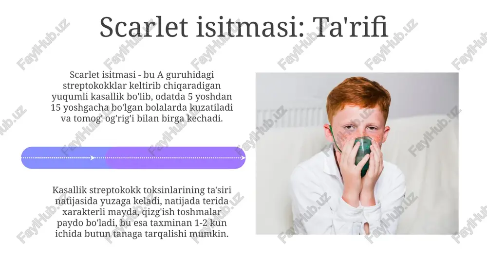 varicella-zoster virusi sabab bo'ladi, bu ikkalasi etiologiyasi bo'yicha fundamental farqni ko'rsatadi. qiyosiy tahlil qiyosiy tahlil, har ikki kasallikning inkubatsiya davrini (masalan, skarlatina 2-5 kun, suvchechak 10-21 kun) aniqlab, yuqumlilik darajasini baholash imkonini beradi. skarlatina va suvchechakning klinik belgilari qiyosiy tahlili toshmalar xarakterini (skarlatinada mayda, suvchechakda pufakchalar) va tarqalish tartibini farqlash uchun muhim. xulosa skarlatinaning prognozi odatda antibiotiklar bilan davolash tufayli 10 kun ichida yaxshi bo'ladi, ammo asoratlar 3 foizdan 5 foizgacha bo'lishi mumkin, bu yurak yoki buyrak kasalliklarini keltirib chiqaradi. suvchechak aksariyat hollarda 1-2 hafta ichida o'z-o'zidan o'tib ketadi, ammo immuniteti zaif odamlar uchun antiviral dorilar yoki vaksinalar yordam beradi va og'ir asoratlarni 0.1 foizdan kamga kamaytiradi. e'tiboringiz uchun rahmat image4.png image5.jpg image6.jpg image7.jpg image8.jpg image9.jpg image10.jpg image11.jpg image12.jpg image13.jpg image14.jpg image15.jpg image16.jpg image17.jpg image18.jpg image19.jpg image20.jpg image21.jpg image1.jpeg image2.jpeg image3.jpeg