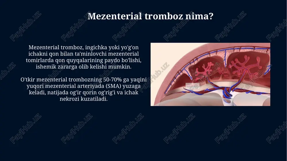 mezentrial tromboz - Page 4