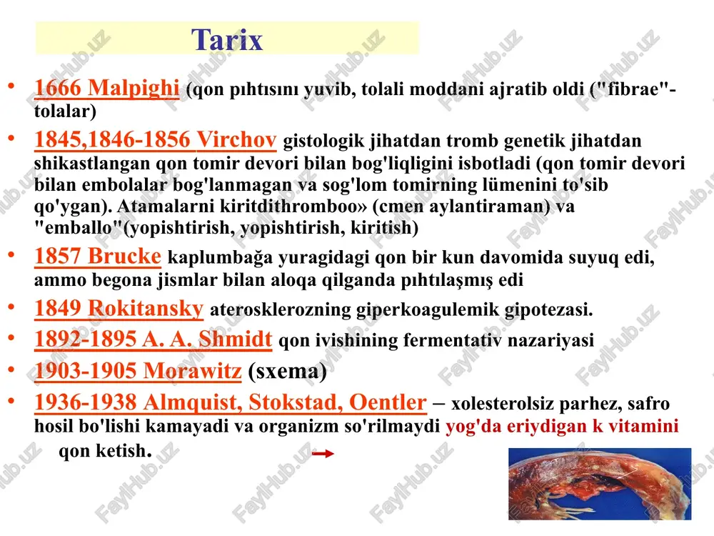 n paydo bo'ladi; - retroperitoneal va teri osti to'qimalaridagi gematomalar (oz sonli, ammo katta, bo'g'imlarda qon ketish va ularning deformatsiyasi yo'q). vaskulit-qizil rang: - teridagi gemorragik toshmalar, nosimmetrik; döküntünün elementlari cheklangan, teridan biroz ko'tarilgan, ularning paydo bo'lishidan oldin qon bilan singdirilgan pufakchalar yoki pufakchalar paydo bo'lishi mumkin; gemorragik elementlar birlashishi mumkin, ularning ustidagi epidermis nekrotik bo'lib, qobiq hosil qiladi; toshma yo'qolganidan keyin pigmentatsiya o'choqlari qoladi; - ichki organlardan qon ketish-oshqozon-ichak trakti, buyraklar. angiomatoz: - doimiy, takroriy qon ketish 1-2 lokalizatsiya (burun, o'pka); - terida, teri osti to'qimasida o'z-o'zidan va travmadan keyingi qon ketishining yo'qligi. trombotsitlar 1844-donne trombotsitlarni kashf etdi, ularni "globulinlar" deb atadi, ular qizil qon tanachalari yoki oq qon hujayralarining parchalari deb taxmin qilingan. 1882 yilda bizzozero trombotsitlarning qonda aylanib yuradigan va qon pıhtısının shakllanishida ishtirok etadigan alohida morfologik guruhga mansubligini aniqladi. 1910 rayt trombotsitlarni megakaryotsitlar bilan bog'lashni taklif qildi. trombotsitlar shakllanishi qonda trombotsitlar darajasining pasayishiga javoban chiqarilgan gumoral …