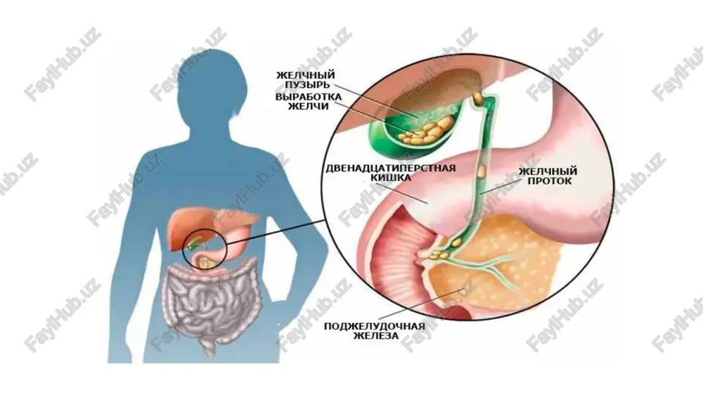 ng and managing cholesterol gallstones. f1000res. 2018;7 [pmc free article] 3) di ciaula a, portincasa p. recent advances in understanding and managing cholesterol gallstones. f1000res. 2018;7 [pmc free article] saytlar: https://www.ncbi.nlm.nih.gov/books/nbk470440/ https://my.clevelandclinic.org/health/diseases/7313-gallstones https://mymedic.uz/kasalliklar/gastroenterologiya/ot-tosh-kasalligi/ e’tiboringiz uchun rahmat😊