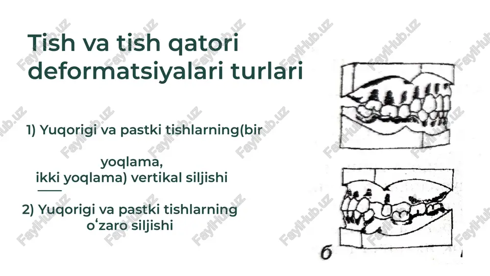 tish qatorlari deformatsiyalar - Page 4