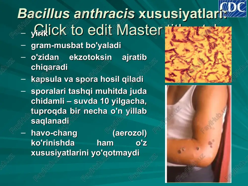 tuguni yallig'langan bemorning ahvoli og'ir – o'mrov osti venasiga kateter qo'yilgan click to edit master title style bullyoz shakli ayrim hollarda pufakchalar katta o'lchamli ham bo'lishi mumkin – bu kasallikni teri shaklining bullyoz turidir click to edit master title style kasallikning 4-8 kunlarida pufakcha – pustula sekin-asta yaraga aylanadi yara og'riqsiz, tubi nekrozga uchragan, atrofida jelesimon shish bo'ladi click to edit master title style kasallikning 9-14 kunlariga kelib yara ustini qora qo'tir qoplay boshlaydi qora qo'tir ham og'riqsiz bo'ladi antibiotiklar terida kuzatilayotgan o'zgarishlarga ta'sir etmaydi click to edit master title style ayrim hollarda qo'tir atrofida ikkilamchi pufakchalar hosil bo'lishi mumkin click to edit master title style vaqt o'tishi bilan qora qo'tir teridan ko'chib tusha boshlaydi click to edit master title style kuydirgining o'pka shaklini rivojlanishi inkubatsion davr 1- 6 kun (1kundan 43 kungacha) avj olish davri haroratni keskin ko'tarilishi taxikardiya muzdek ter bosishi ko'krak kafasi / bo'yin shishi hansirash shok …